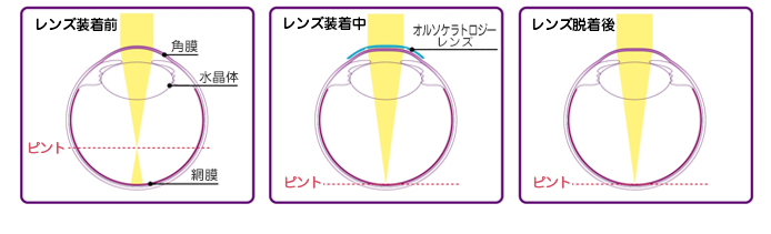 レンズ装着前、装着中、脱着後のイメージ